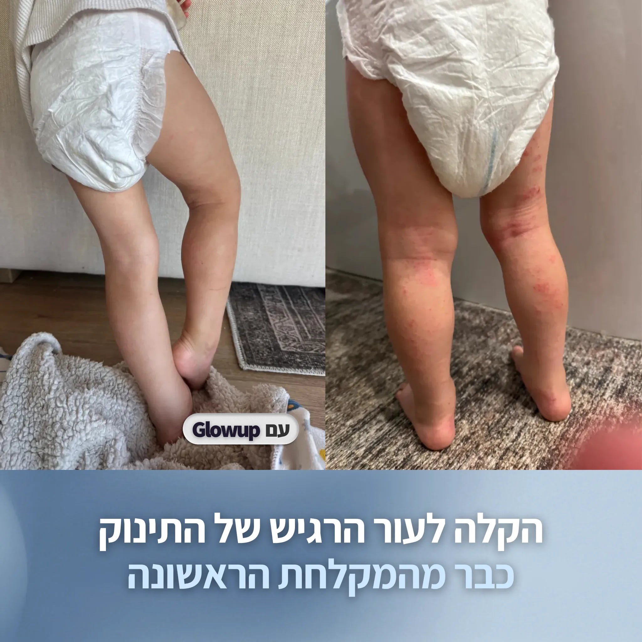 מסנן המקלחת לעור רגיש | Glowup