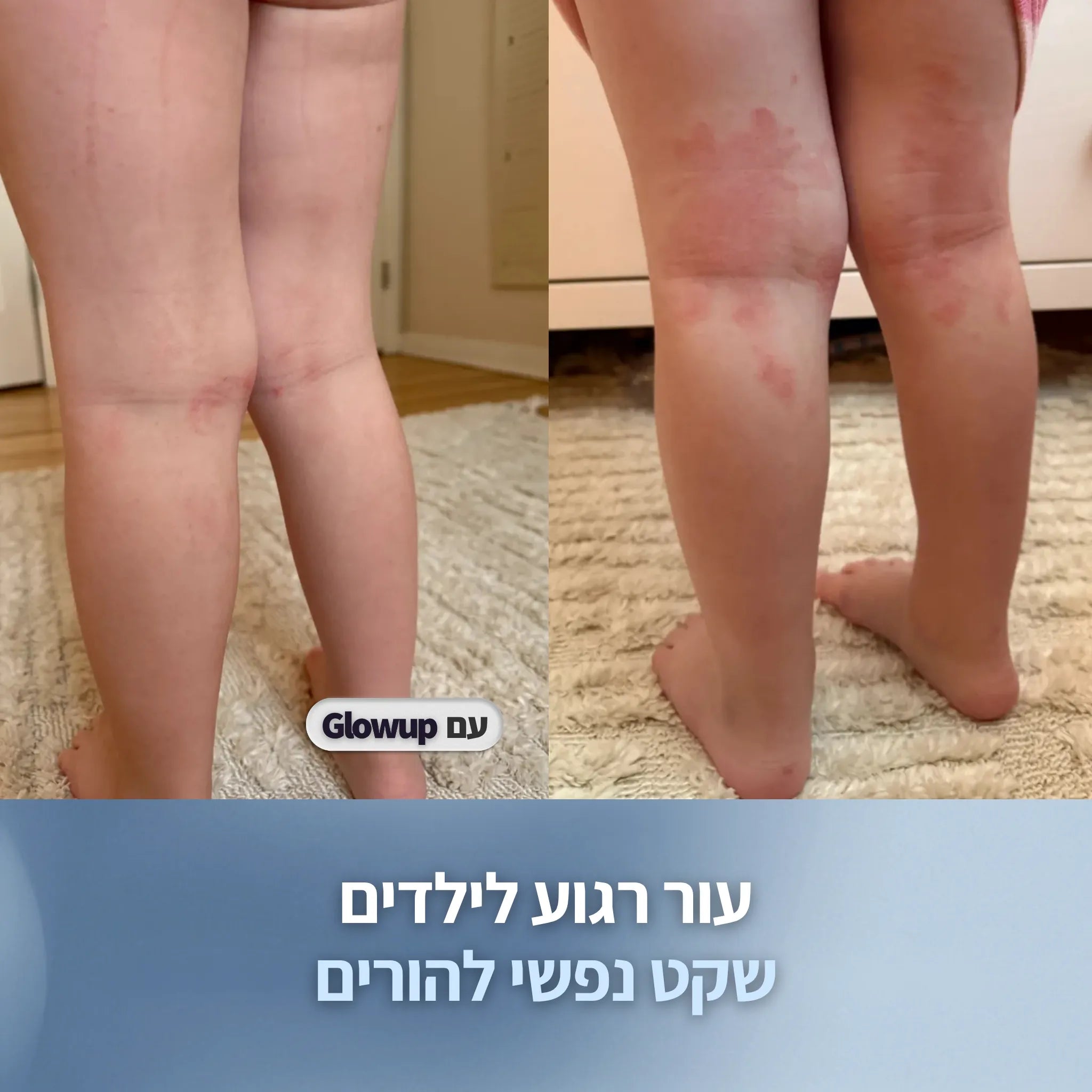 מסנן המקלחת לעור רגיש | Glowup