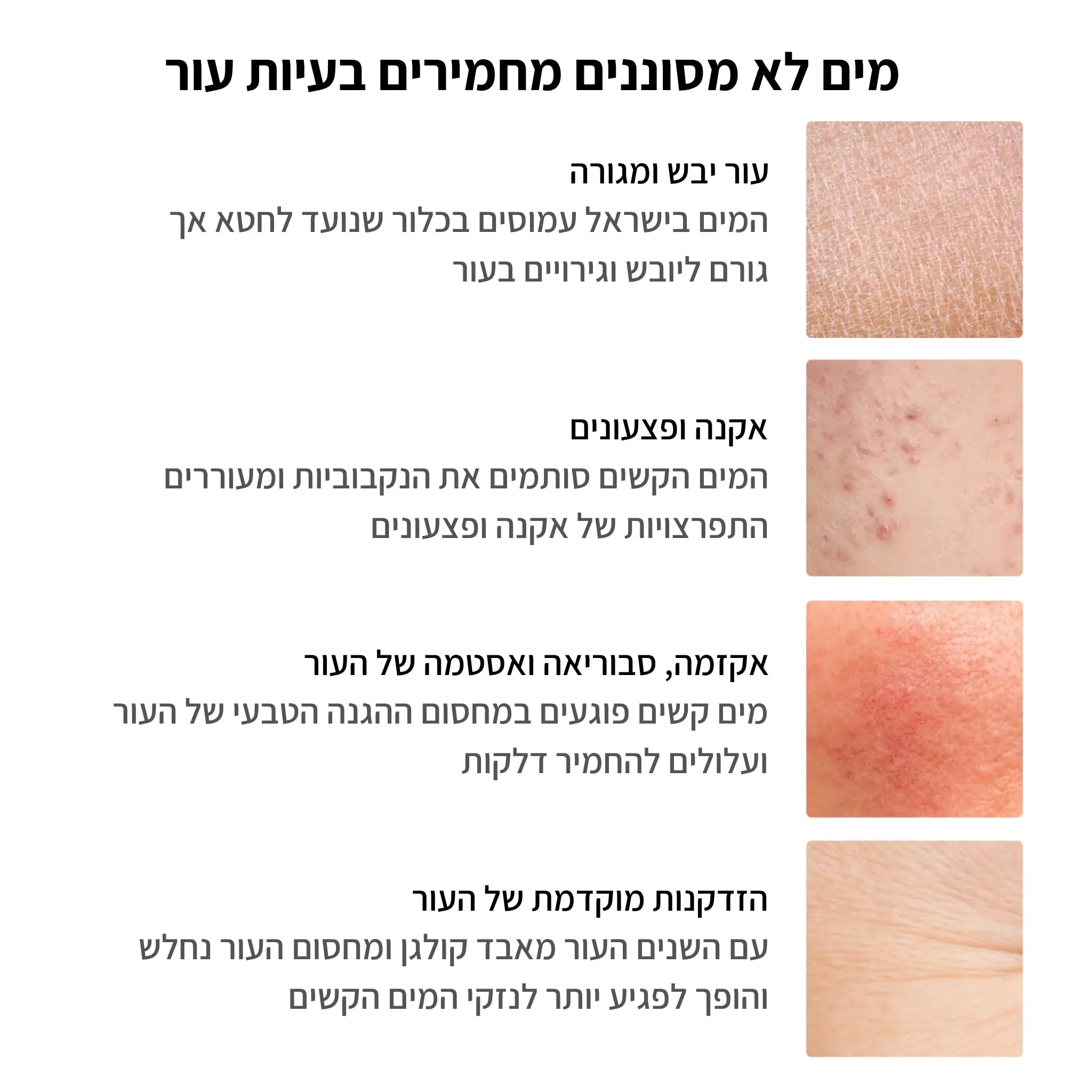 מסנן המקלחת לעור רגיש | Glowup